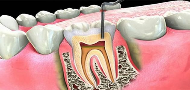 Dr Shatha Duhair - Endodontics